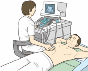 腹部超音波検査