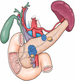 IPMNのイメージ図